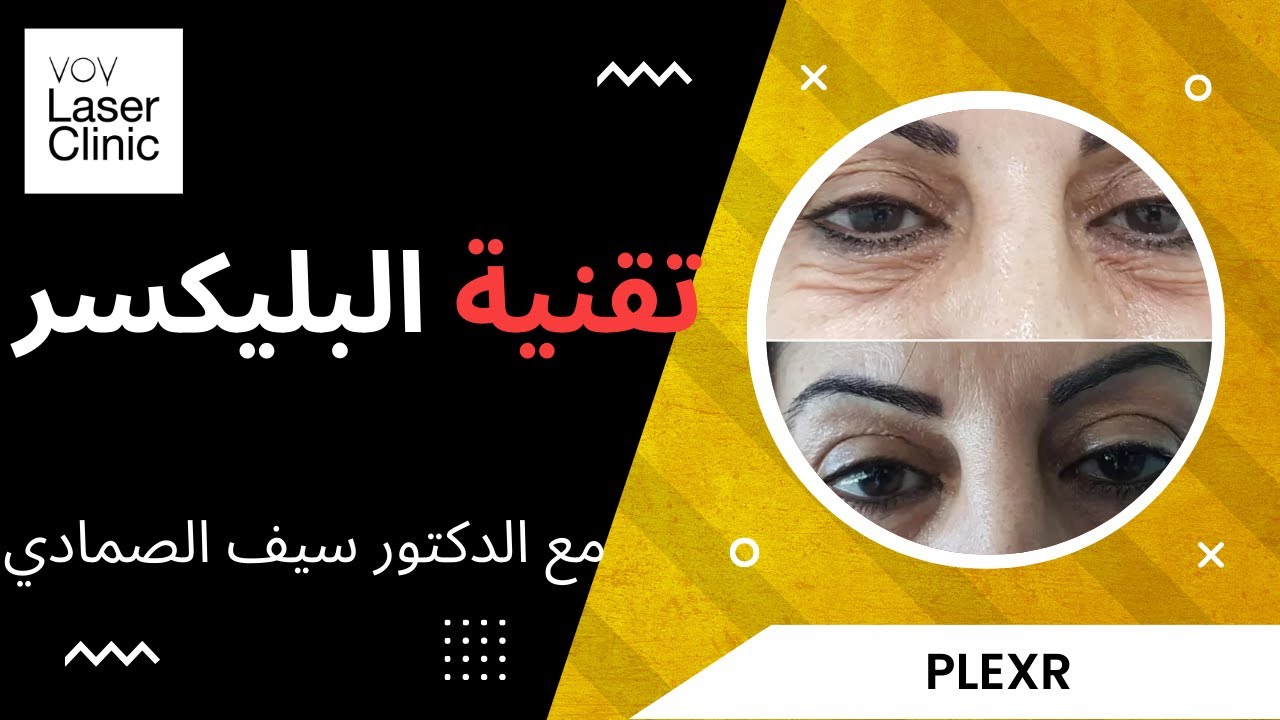Plexr تقنية البليكسر