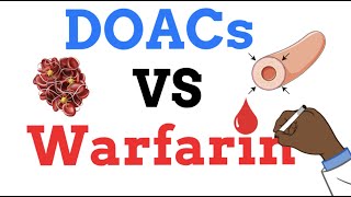 DOACs vs Warfarin - WHEN TO USE ONE vs THE OTHER