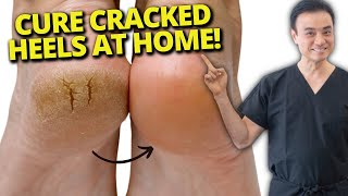 7 Cracked Heel Home Remedies That REALLY Work! screenshot 4