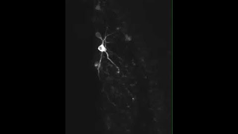 Spontaneous activity of Neurons in Songbird Organotypic Slice
