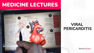 Viral pericarditis