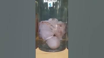 Stages Of Real Human Fetus