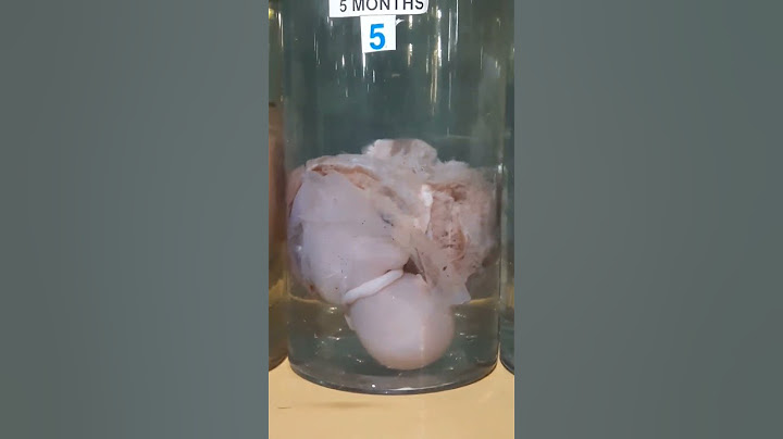 Stages Of Real Human Fetus