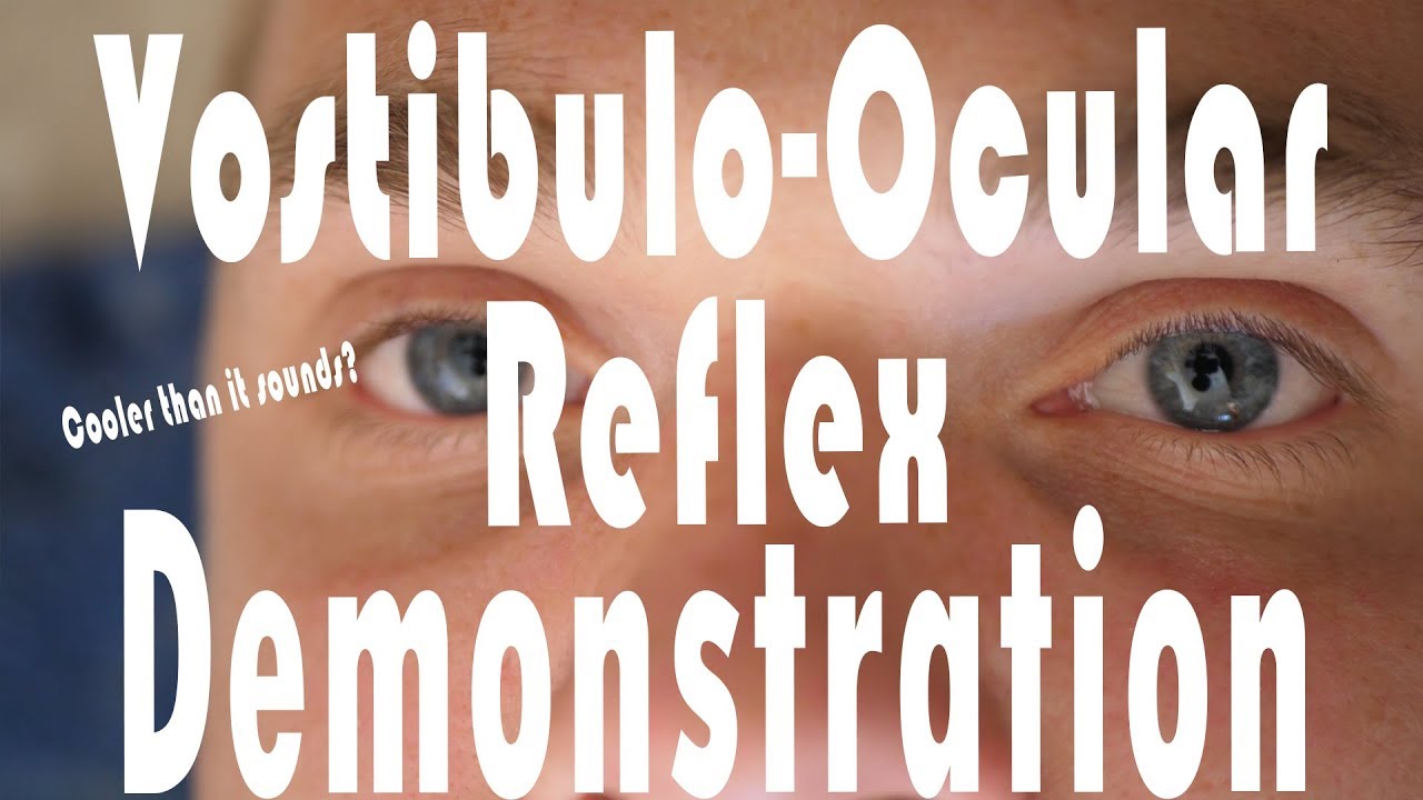 Vestibulo Ocular Reflex Animation