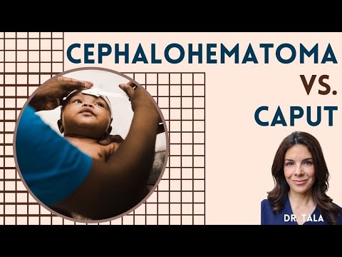 Videó: Cephalohematoma újszülötteknél