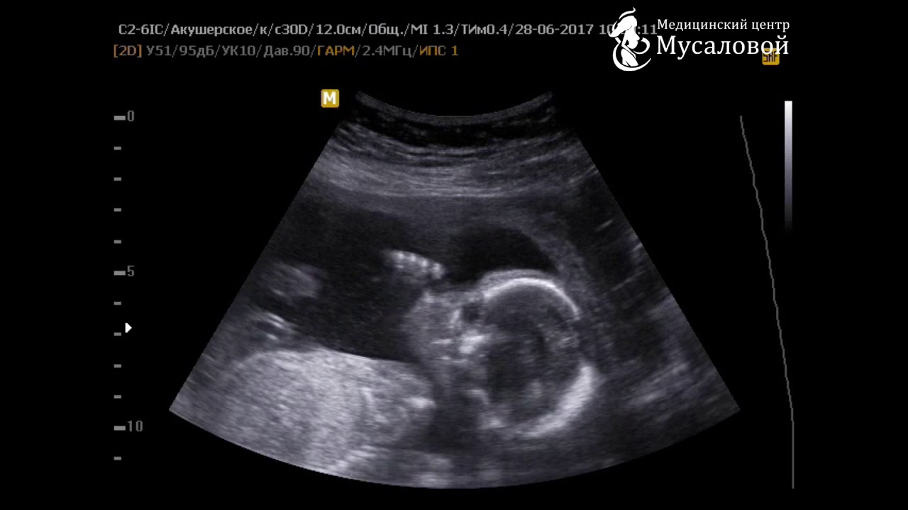 Чем занимается малыш в животе у мамы? - YouTube