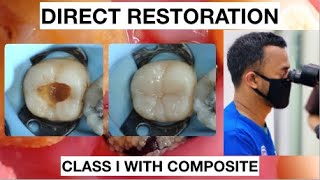 Step by Step Layering Composite I Simple Way | General Dentist Griya RR