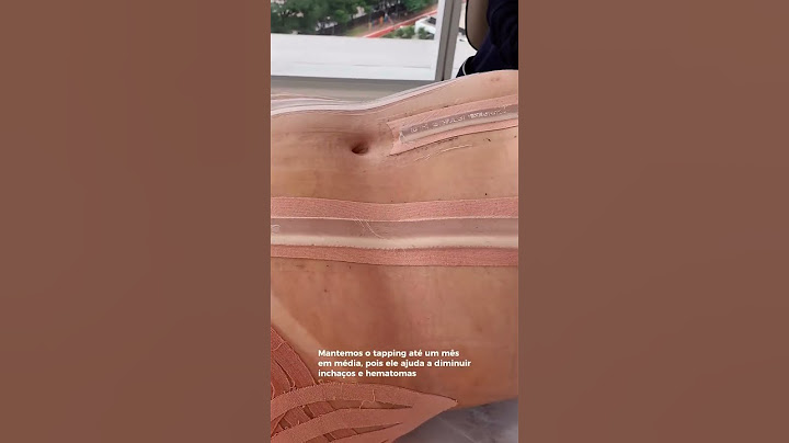 Como é o Pós-Operatório de uma LIPO HD (cirurgia)