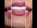 Cosmetic Dentistry
