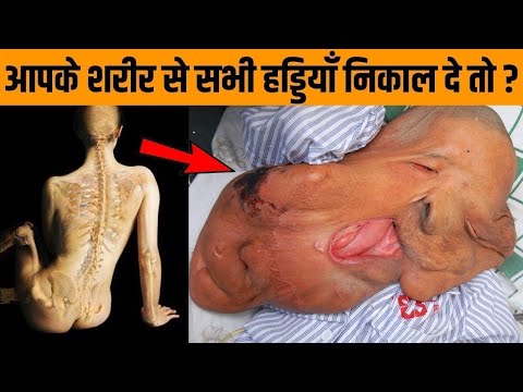 क्या होगा अगर हमें बिना हड्डी के जीना पड़े | What If We Have No Bones In Body