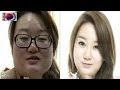 عمليات التجميل في كوريا,إجابات لكل ما قد يخطر ببالك
