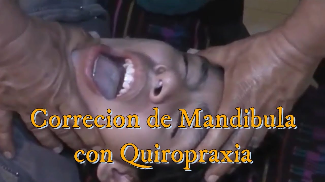 tratamientos resistencia a la insulina Mandibula, Ajuste, Correcion, Mordida, Cruzada, Maniobra, Alivio,Quiropraxia, Huesero, Quiropractico