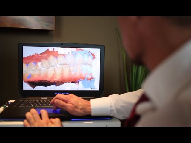 Creating Perfect Teeth with the Latest Dental Technologies