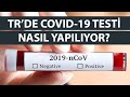 Hepimizin Merak Ettiği Soru: Türkiye&#39;de Corona Virüsü Testi Nasıl Yapılıyor? Paralı mı? Nerede?