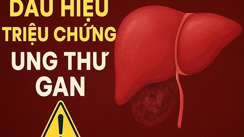 [UNG THƯ GAN]: CÁC DẤU HIỆU VÀ TRIỆU CHỨNG UNG THƯ GAN