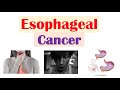 Esophageal Cancer | Risk Factors, Pathogenesis, Signs and Symptoms, Diagnosis, Treatment