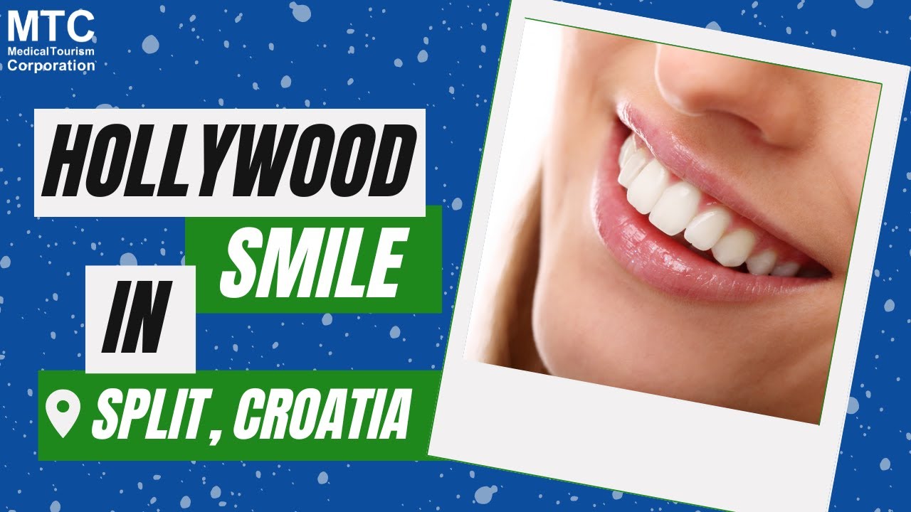 Quick & Safe Smile Makeover in Split, Croatia