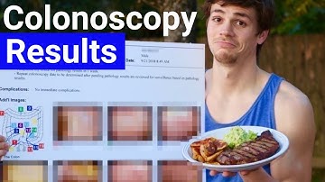 What I Eat to Optimize My Gut | Daily Routine After UC & IBD