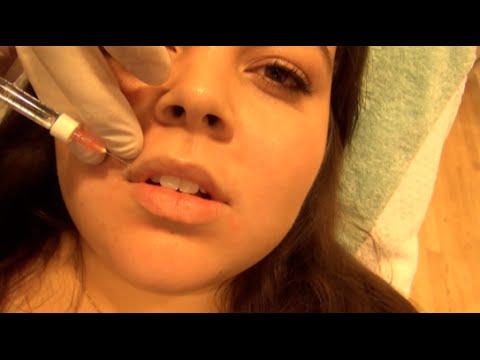 Video: Bloggers Læber Blev Blå På Grund Af Mislykket Kosmetisk Kirurgi