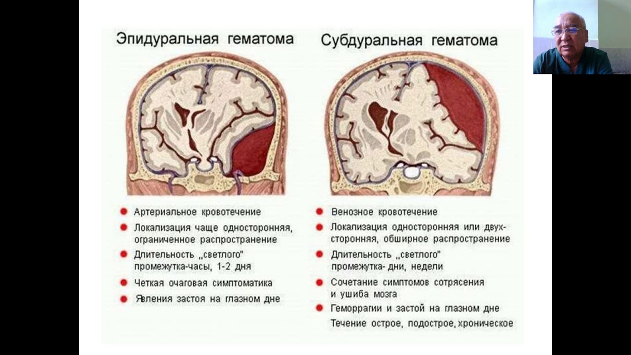 Рецидив мозга