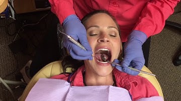 Using the diagnodent