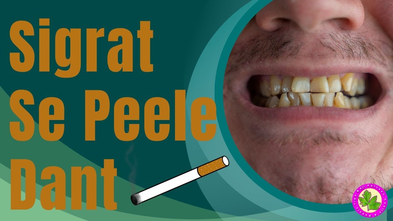 cigarettes yellow teeth How Can You Fix Cigarette-stained Is smoking bad for my