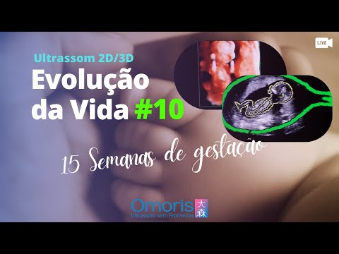 Kehamilan 15 minggu - Apa peran Doula dalam kehamilan? Ultrasound - Evolusi Kehidupan #10