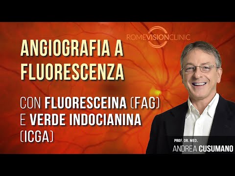 Video: Angiografia Con Fluoresceina: Scopo, Procedura E Risultati