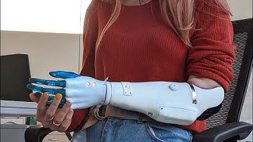 Esper Bionics. An MVP