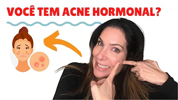 Quais exames para saber se a acne e hormonal?