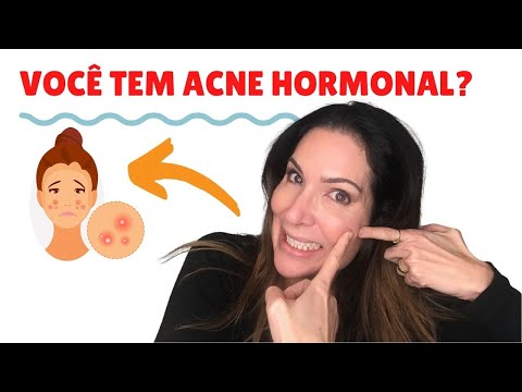 Vídeo: Acne Hormonal: Por Que Acontece E Como Tratá-lo