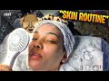 MY SKIN IS BREAKING OUT!!! **HOW KIMO HELPS MY ACNE**