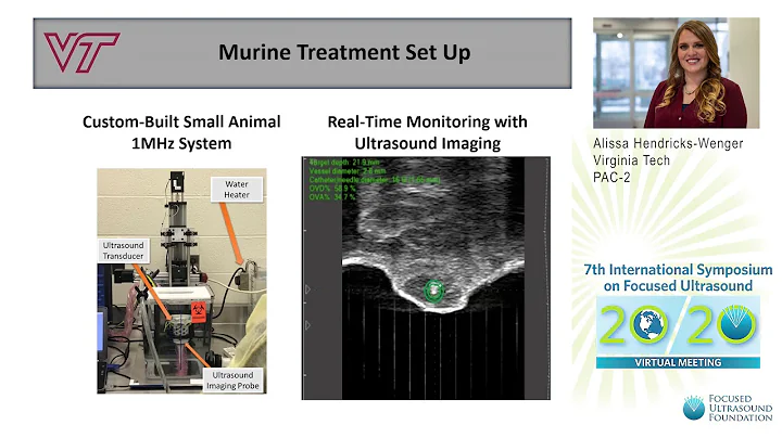 A. Hendricks-Wenger - Histotripsy: Effective Pancreatic Tumor Ablation Strategy, Immunity (2020)
