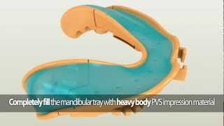 DENTCA - Making the Mandibular Impression