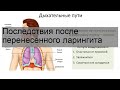 Последствия после перенесенного ларингита