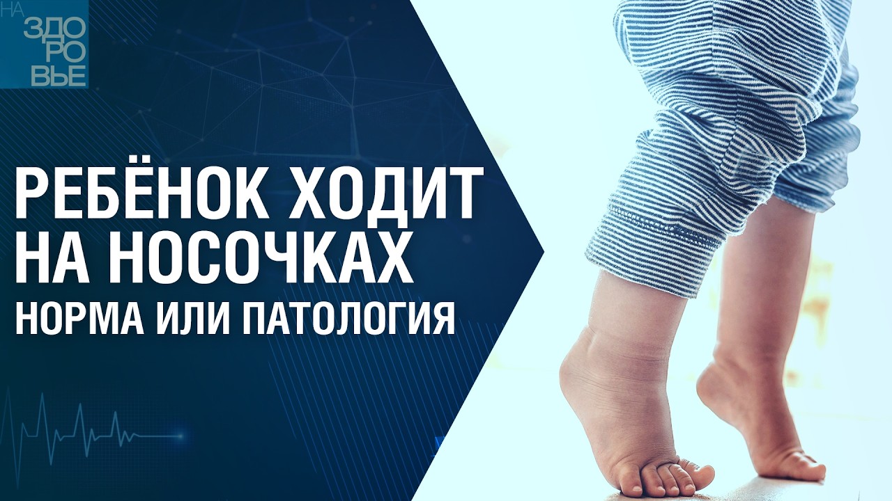 Ребёнок ходит на носочках. Норма или патология. На здоровье 07.03.2026