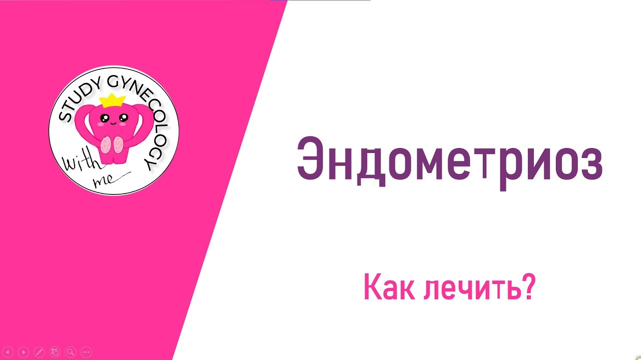 ГИНЕКОЛОГИЯ Эндометриоз | Лечение - К ЭКЗАМЕНУ - YouTube
