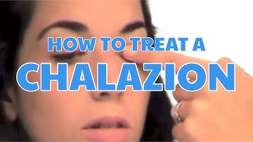 How to treat a chalazion