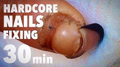 😱HARDCORE NAILS FIXING IN 30 minutes. HARDEST WORK I'VE EVER DONE with GEL NAILS and HARDWARE MANICU