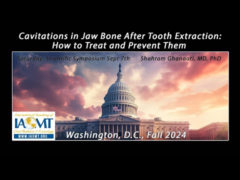 Cavitations in Jaw Bone After Tooth Extraction: How to Treat and Prevent Them. Shahram Ghanaati, MD.