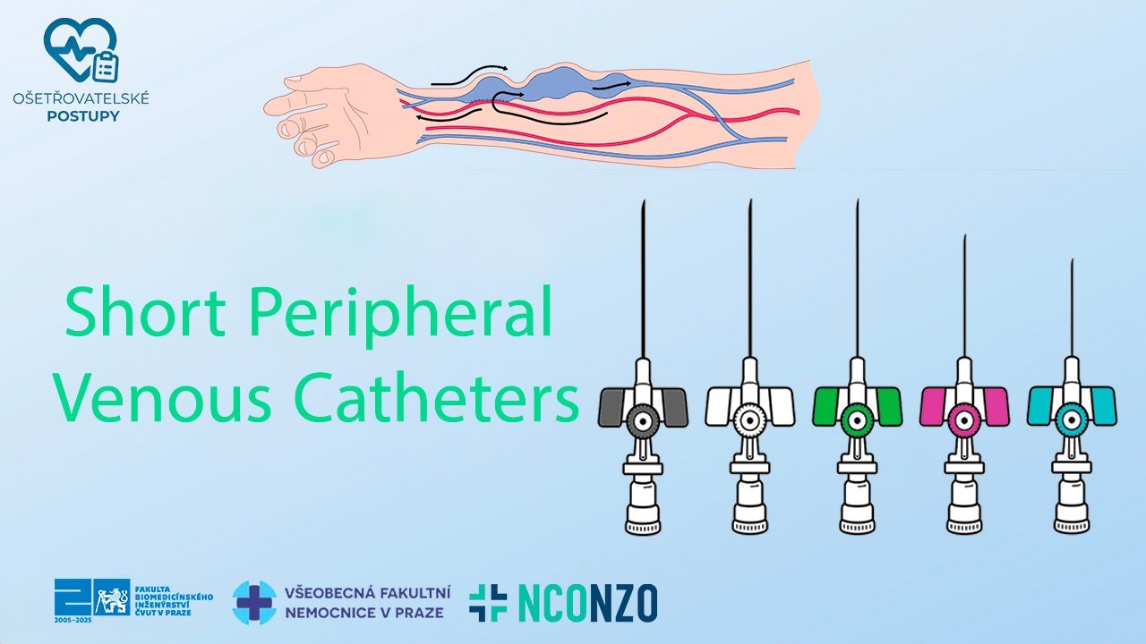 SHORT PERIPHERAL VENOUS CATHETERS 1/4 - GENERAL PROCEDURE | NURSING AND HEALTHCARE PROCEDURES