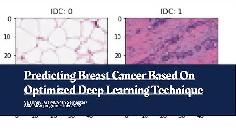 Predicting Breast Cancer Based On Optimized Deep Learning Technique