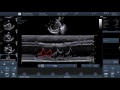 Video 2 - How to perform basic echocardiographic measurements -  EPSS