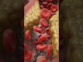 What Happens During a Heart Attack? | Minute by minute (Realistic 3D Medical Animation)
