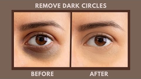 Fix Dark circles in Photoshop #viral #shorts #photoshoptutorial #photoshop #videos #trending