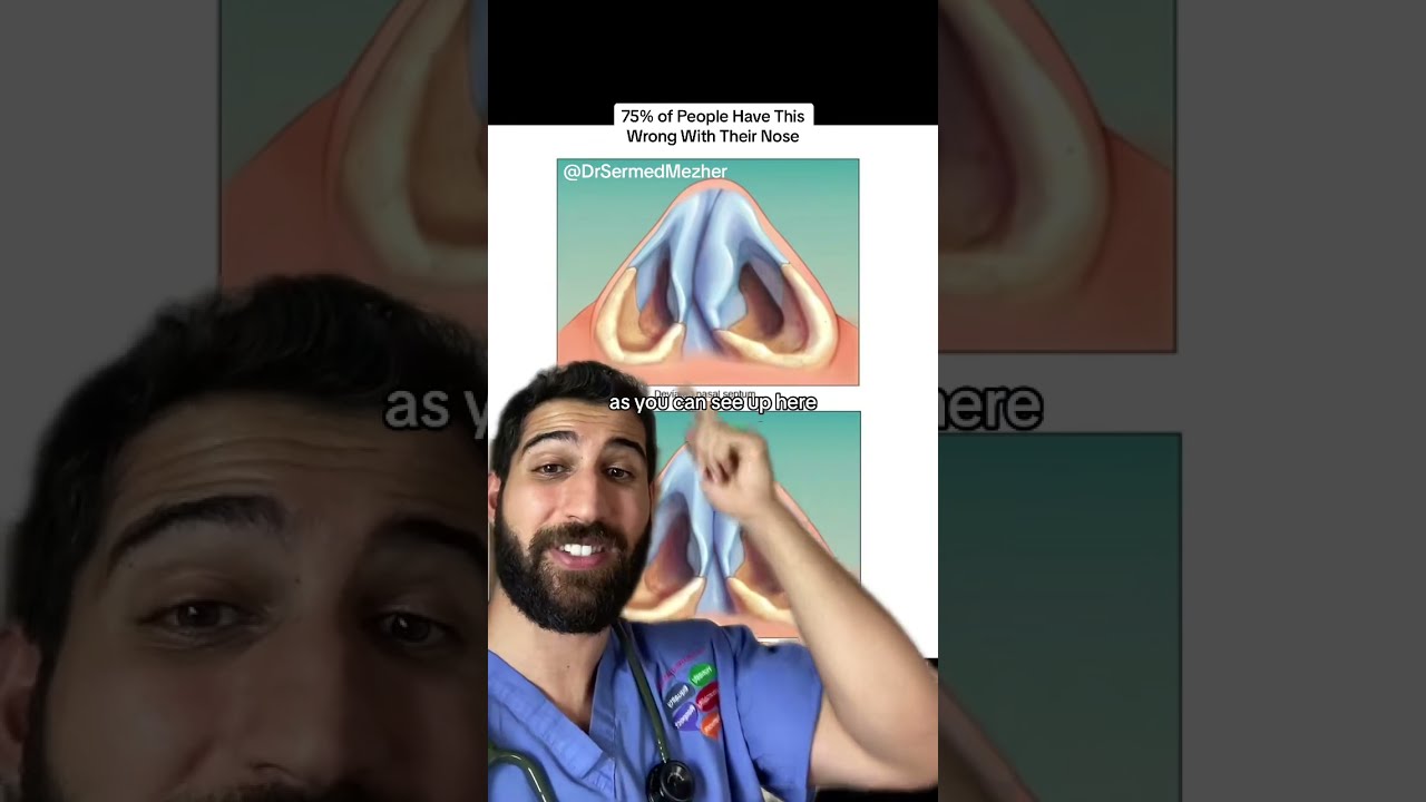 75 Of People Have This Wrong With Their Nose Breathing