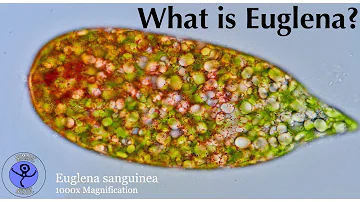 Can euglena make you sick?