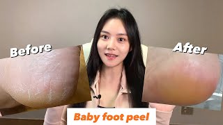 [Baby Foot⭐️]베이킹소다와 식초로 애기발 만드…