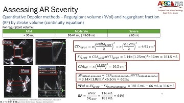 Rapid Review: Aortic Regurgitation and Stenosis and the ESC Guidelines