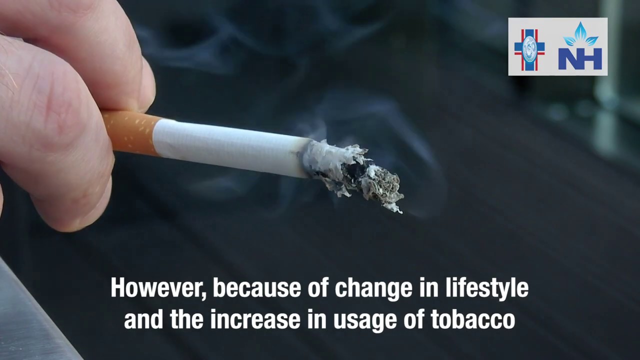 Lung Cancer - Causes and Risk Factors | Dr. Raajit Chanana (English)
